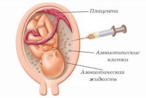 Изображение 1: Определение пола ребенка при беременности - ЭКО-блог