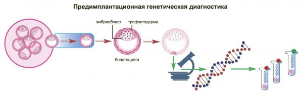 Изображение 1: Определение пола ребенка при беременности - ЭКО-блог
