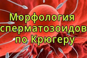 Изображение: Морфология сперматозоидов по Крюгеру - ЭКО-блог