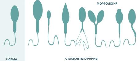 Изображение : Морфология сперматозоидов по Крюгеру - ЭКО-блог