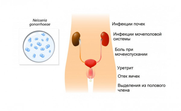 Изображение 3: Инфекционные заболевания у мужчин
