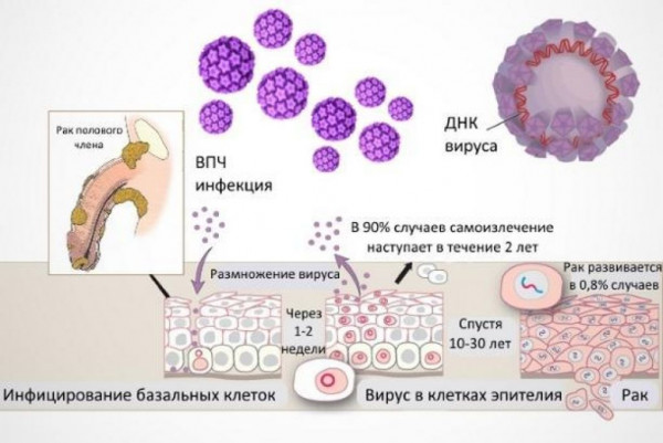 Изображение 6: Инфекционные заболевания у мужчин