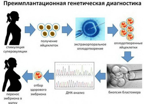 Изображение 4: Анализы на генетику как оценка рисков при планировании беременности - ЭКО-блог