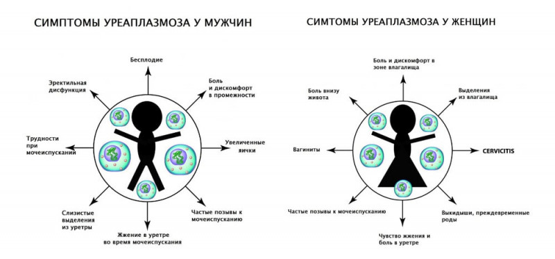 Изображение 3: Может ли уреаплазма быть причиной бесплодия - ЭКО-блог