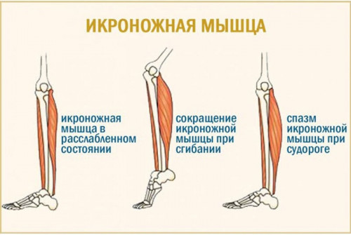 Изображение 1: Сводит ноги при беременности - ЭКО-блог