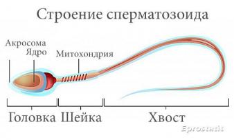 Изображение 1: Причины появления и лечение аномальных сперматозоидов - ЭКО-блог