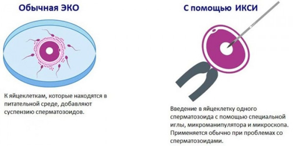 Изображение 3: Полиспермия уменьшает шансы на зачатие - ЭКО-блог