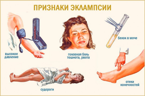 Изображение 3: Обморок во время беременности - ЭКО-блог