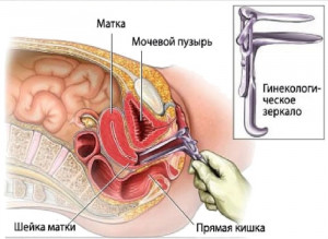 Изображение 2: Гипоменорея. Скудные месячные - ЭКО-блог