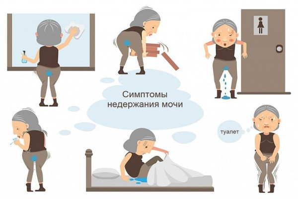 Изображение 3: Недержание мочи после родов - ЭКО-блог