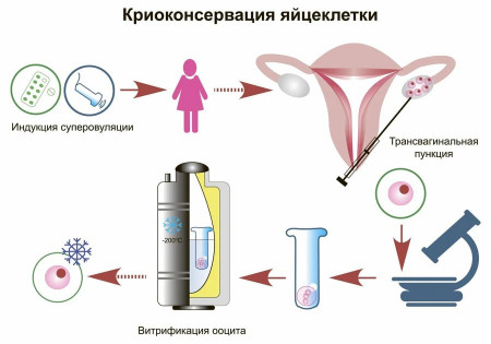 Изображение 3: Заморозка яйцеклеток после 35 лет - шансы - ЭКО-блог