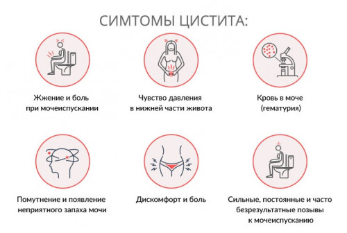Изображение 1: Цистит при беременности: симптомы и принципы лечения - ЭКО-блог