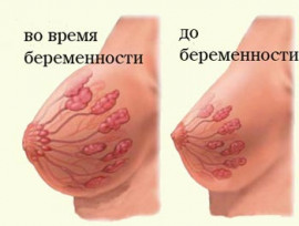 Изображение 2: Почему возникает боль в груди во время беременности - ЭКО-блог