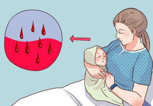 Изображение 1: Кровотечение после родов - ЭКО-блог