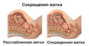 Изображение 2: Гинипрал при беременности — инструкция - ЭКО-блог