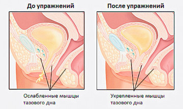 Изображение 2: Упражнения Кегеля: эффективная гимнастика для интимных мышц - ЭКО-блог