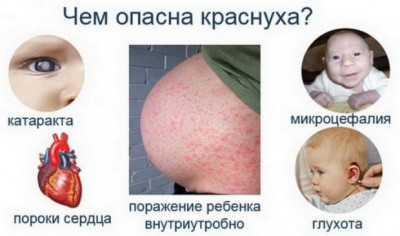 Изображение 2: Почему краснуха так страшна при беременности? - ЭКО-блог