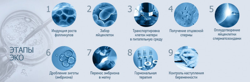 Изображение 2: Вспомогательные репродуктивные технологии в лечении мужского бесплодия - ЭКО-блог