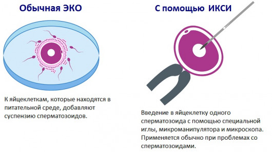 Изображение 3: Вспомогательные репродуктивные технологии в лечении мужского бесплодия - ЭКО-блог