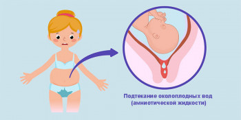Изображение 1: Что такое подтекание околоплодных вод и чем это грозит - ЭКО-блог