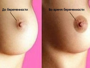 Изображение 3: Первые признаки беременности до задержки месячных - ЭКО-блог