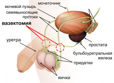 Изображение 1: Мужская контрацепция - ЭКО-блог