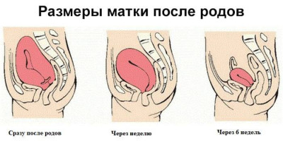 Изображение 1: Субинволюция матки - ЭКО-блог