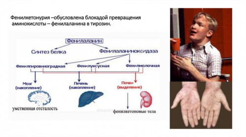 Изображение 1: Фенилкетонурия - ЭКО-блог