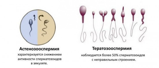 Изображение 1: Астенотератозооспермия - ЭКО-блог