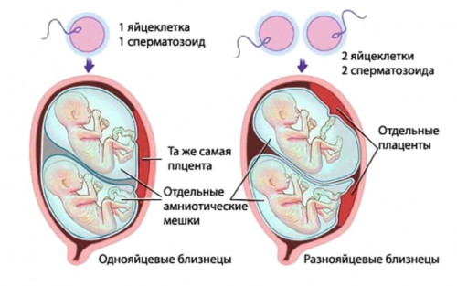 Изображение 4: Как забеременеть близнецами? - ЭКО-блог