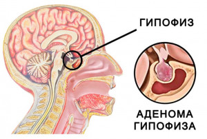 Изображение 5: Тиреотропный гормон повышен - ЭКО-блог