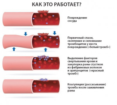 Изображение 1: Анализ крови на коагулограмму - ЭКО-блог