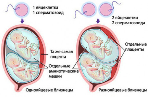 Изображение 2: Многоплодная беременность - ЭКО-блог