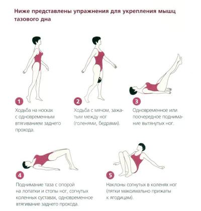 Изображение 7: Опущение матки  - ЭКО-блог