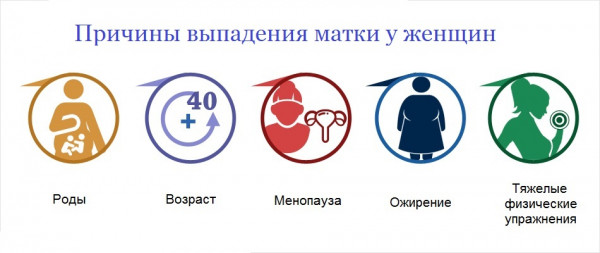 Изображение 2: Опущение матки  - ЭКО-блог