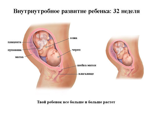 Изображение 2: 32 неделя беременности - ЭКО-блог
